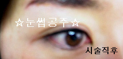 눈썹공주 이미지