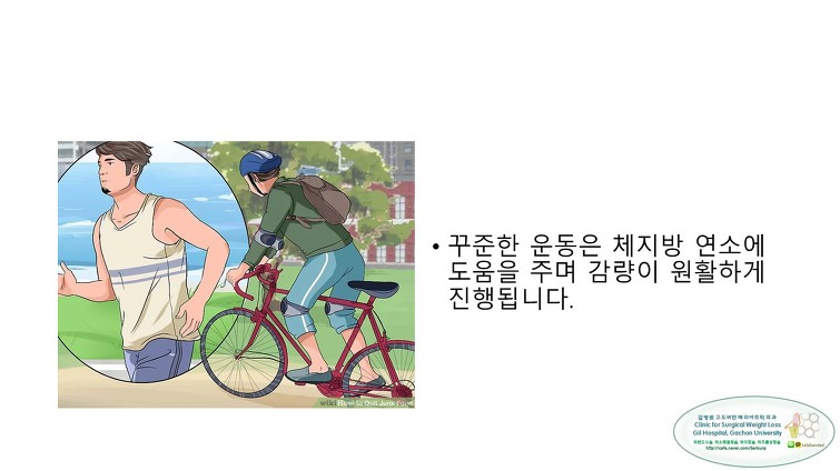 고도비만수술의 대세 위소매절제술 후 일반식하기